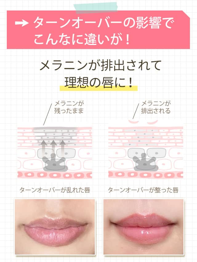 ターンオーバー