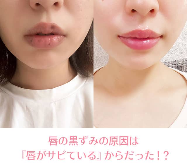 唇のケア