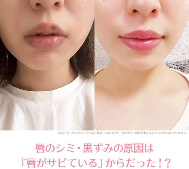 唇のケア