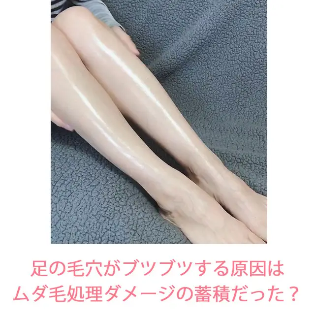 シルキークイーンでケアした足